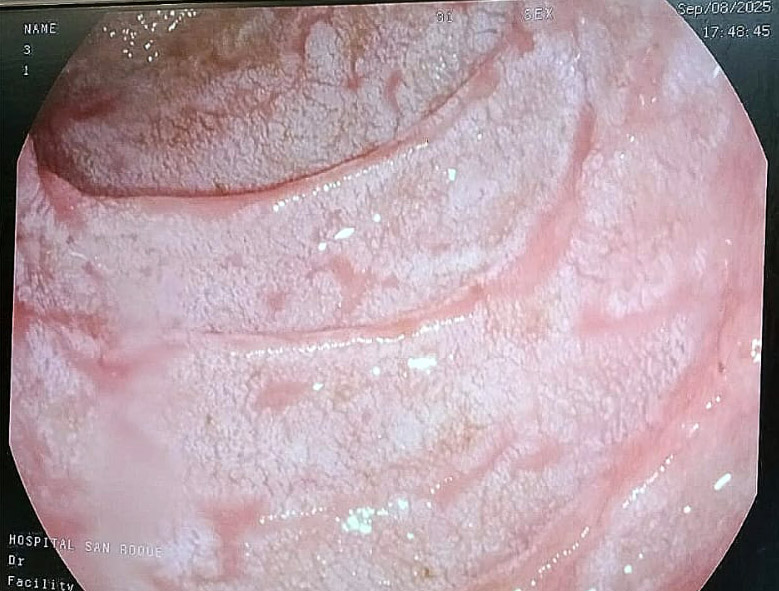 imagen-endoscopia