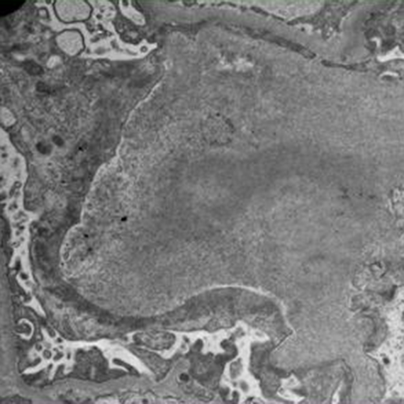 microscopia-electronica-02