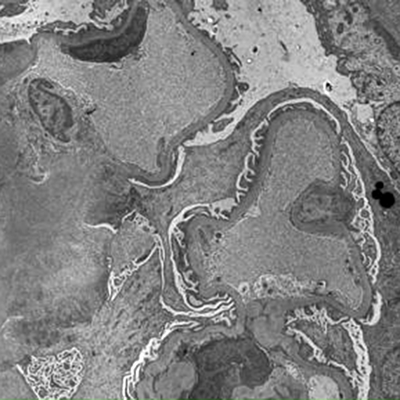 microscopia-electronica-03