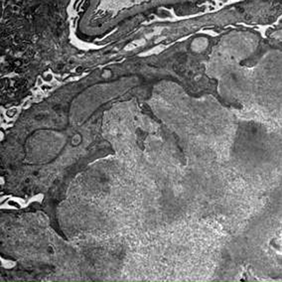 microscopia-electronica-04